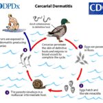 Please Don’t Feed the Ducks – Stop Swimmers Itch Rash!